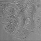 HeLa-GFP-Phase